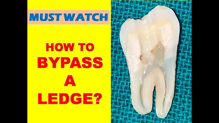 How to Bypass A Ledge?? (With Subtitles)