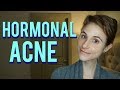 Hormonal acne| Dr Dray Q&A