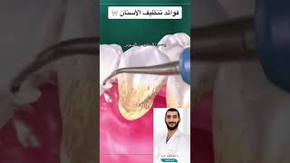 فوائد تنظيف الأسنان