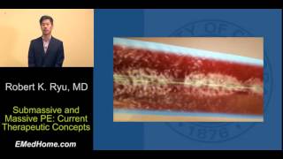 Paradigm Shift: New Technology for Treatment of Acute Pulmonary Embolism, Lecture 1