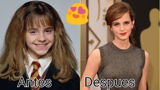 Emma Watson 1990-2016 Antes Y Despues [Before Ando Anfter]