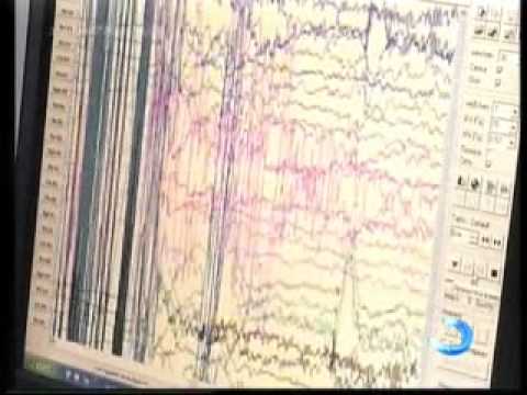 უფასო სამედიცინო კონსულტაციები აჭარის მაღალმთიანეთში