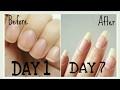 DIY | Grow your nails super fast,long n strong in just 7 days!!
100% guarenteed | 100% natural