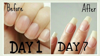 DIY | Grow your nails super fast,long n strong in just 7 days!!100% guarenteed | 100% natural