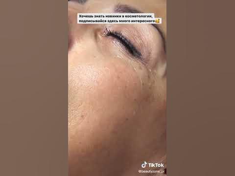 Чудо коллагеновые нити для красоты. - YouTube