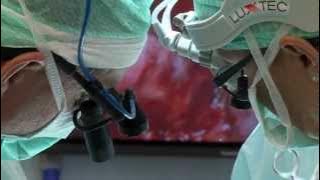 Uterus Transplantation Research Project, University of Gothenburg