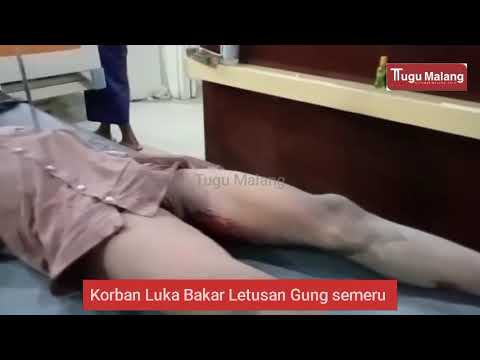 Erupsi Gunung Semeru, Sejumlah Warga Desa Alami Luka Bakar