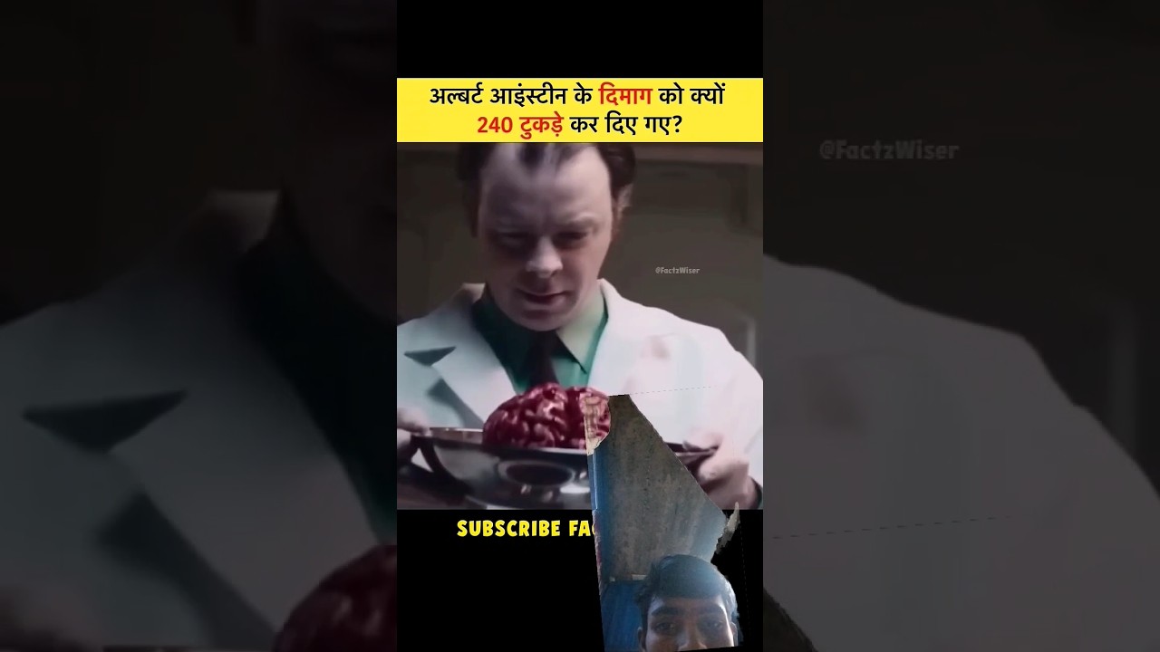 अल्बर्ट स्टेन ने कहा था कि मेरे मरने मेरा कोई शरीर परपरीक्षण नहीं होगा दिमाग को 140 टुकड़ा में किया