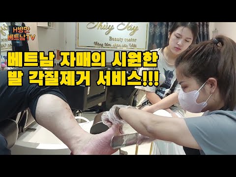 'Only 10,000 Won' Vietnamese foot exfoliation, full foot care service, and foot scrub provided by...