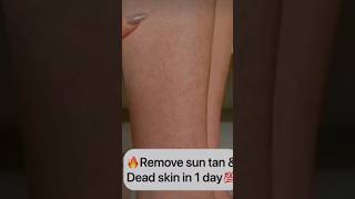 Tan Remove In A Day | Pack For Tan Removal   #skincare #shortsviral #suntanremoval