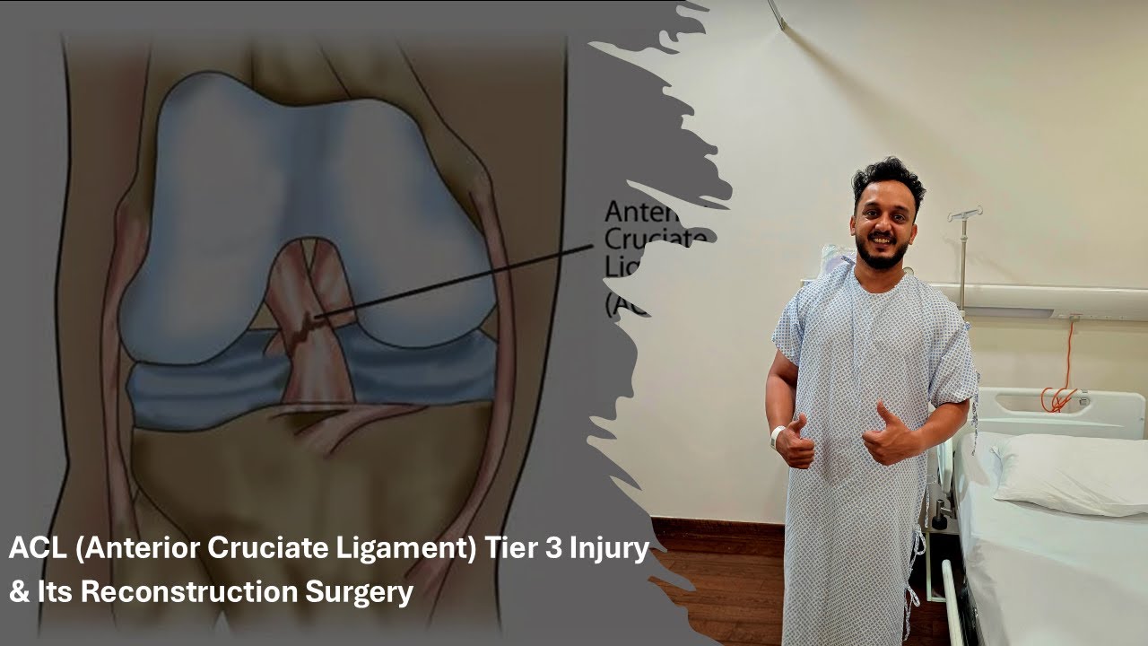ACL Surgery and Recovery Tips #asterhospitals #surgery #football