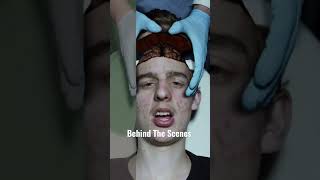 Behind The Scenes of the Head Removal 🧠