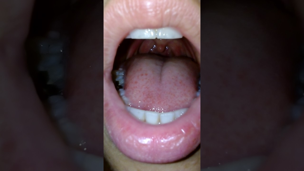 Pulse In Throat 2