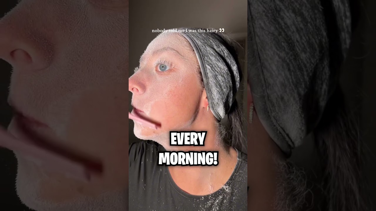 This Girl Has A Rare Disease! 😱