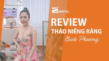 [Review niềng răng]: #13 Kết quả niềng răng của Bích Phương