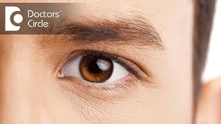 What are the possible side effects of cataract surgery?-Dr. Dipali Prabhu