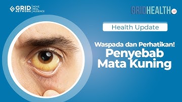 Waspada dan Perhatikan! Ini Penyebab Mata Kuning