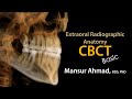 Basic CBCT (ConeBeam CT) Anatomy