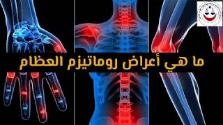 # اعراض الروماتيزم - مجمع العيادات الطبيه للساده اعضاء الهيئات القضائية بالقاهرة