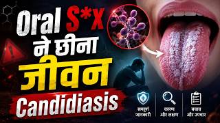 Oral S*x ने छीना जीवन Candidiasis | what is Candidiasis | how to cure Candidiasis | Oral Infection