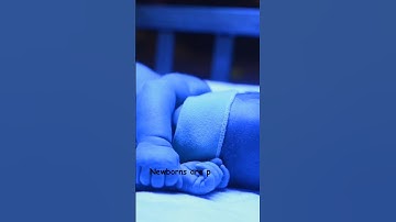Why Do We Show Newborns to the Sun? #newborn #babyhealth #facts #labbaby