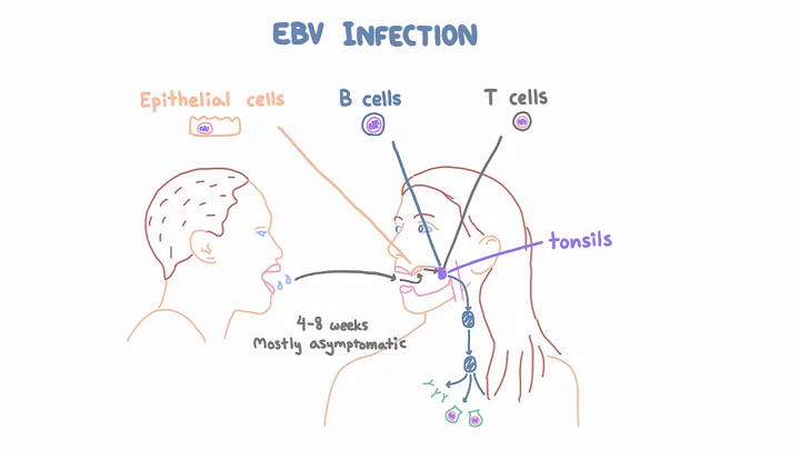 EBV and Mononucleosis - Pathogenesis and Clinical Presentation