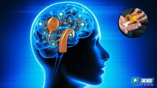 Neuroplastic Promoting Medications for Cochlear Implant Recipients