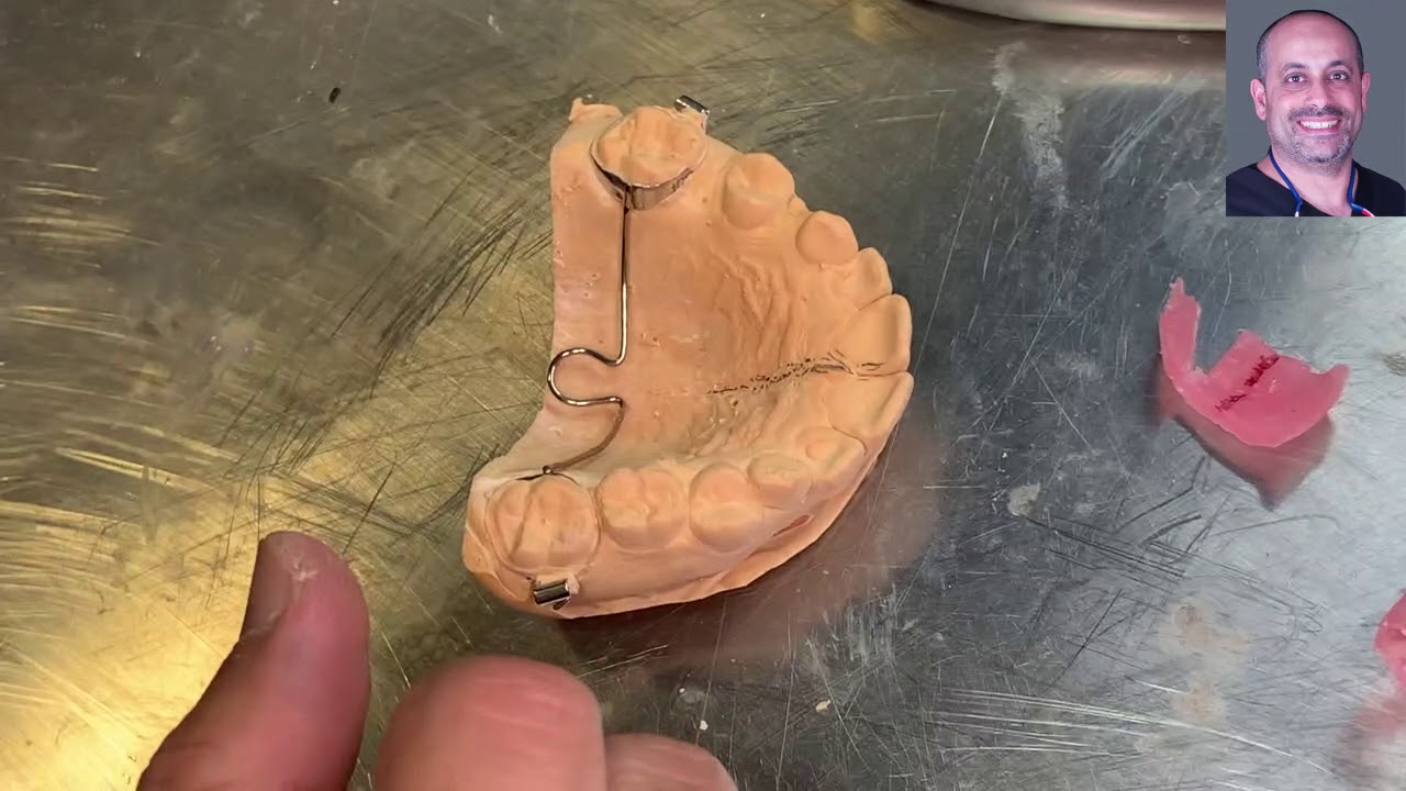 F021 TPA transpalatal arch and soldering orthodontic laboratory step