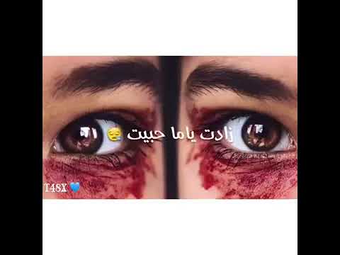 شوكت يا دنيا أرتاح 