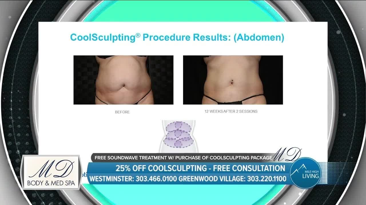 MD Body & Med Spa // Reopening May 8! // Coolsculpting Package YouTube