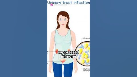 Quick Tips to Prevent UTIs @uti @healthcare