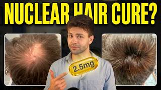 2.5mg Dutasteride: NUCLEAR Hair Loss Cure?!