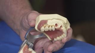 The Importance of Replacing Missing Teeth - Harrisonburg, VA - Dr. Steven Saunders