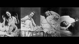 Female hysteria - Wikipedia Spoken Articles