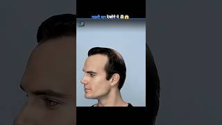 Why Man Goes Bald 😱 #shorts #bald