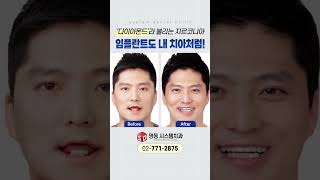 내 치아처럼! 다이아몬드라 불리는 지르코니아 임플란트 [명동 시스템치과]