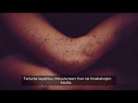 Video: Hepatiitti E: Oireet, Hoito Ja Ehkäisy