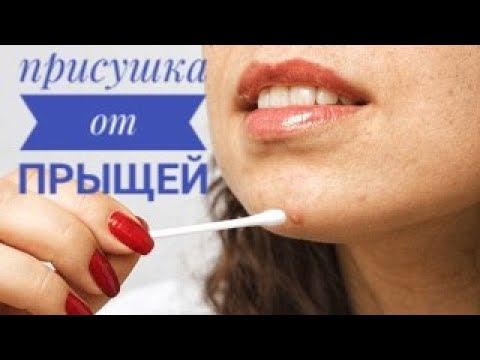 Присушка от прыщей. Спиртовой левомицетин от прыщей.
