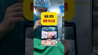 Tại sao không nên tiêm filler mũi| Bác sĩ Đình Dương| #bsdinhduongthammy