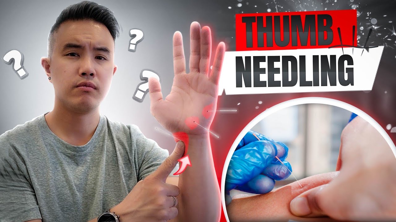 The Most AGGRESSIVE Muscle Release - Thumb Edition 👍🏼 (with physio ...