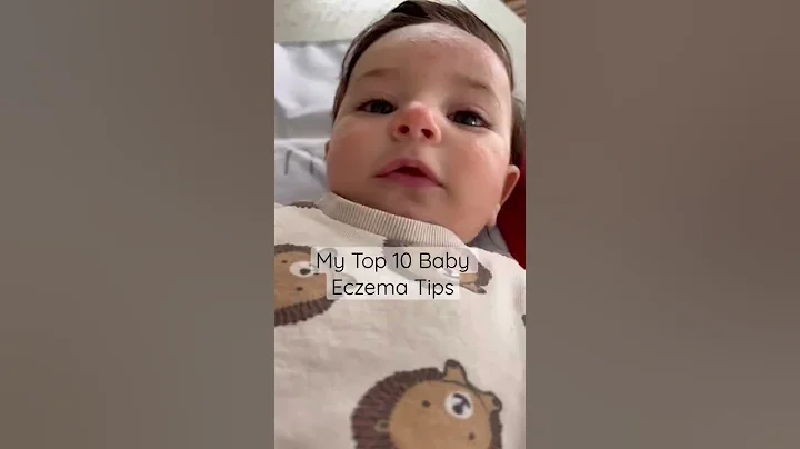 Top 10 Tips to Heal Baby Eczema - DayDayNews