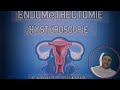 Endomtrectomie hystroscopie c a djennane