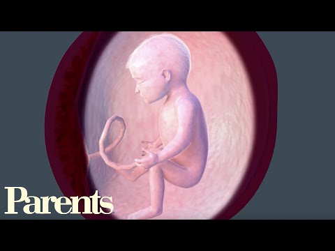 Video: Toxicosis during pregnancy: timing, how to deal, reviews