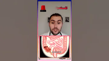 طبيب يشرح كل ما يجب أن تعرفه عن المصرانة الزايدة الزائدة الدودية 