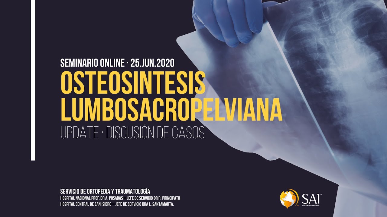 Osteosintesis Lumbosacropelviana. Seminario Online South America Implants