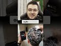 POR QUE SHAMPOO SOZINHO NÃO CONSEGUE COMBATER A CALVÍCIE