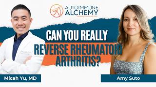Rheumatoid Arthritis Remission: Off All Meds in 2 Years Without Biologics