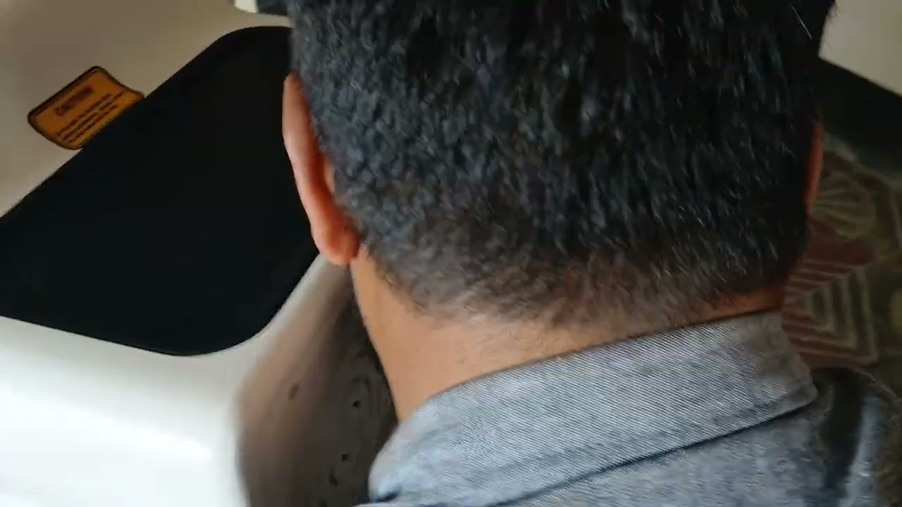 Micro needle RF machine installation Video in Bangladesh # scar removal treatment machine 