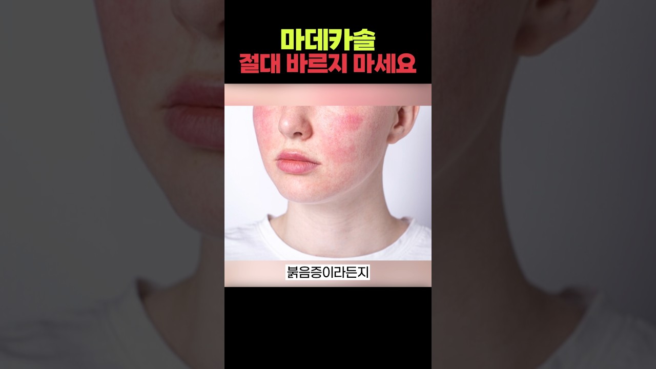 피부과 전문의가 알려주는 마데카솔 제대로 쓰는 법