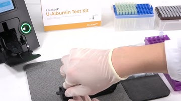AUTODX U-Albumin Live Video V1